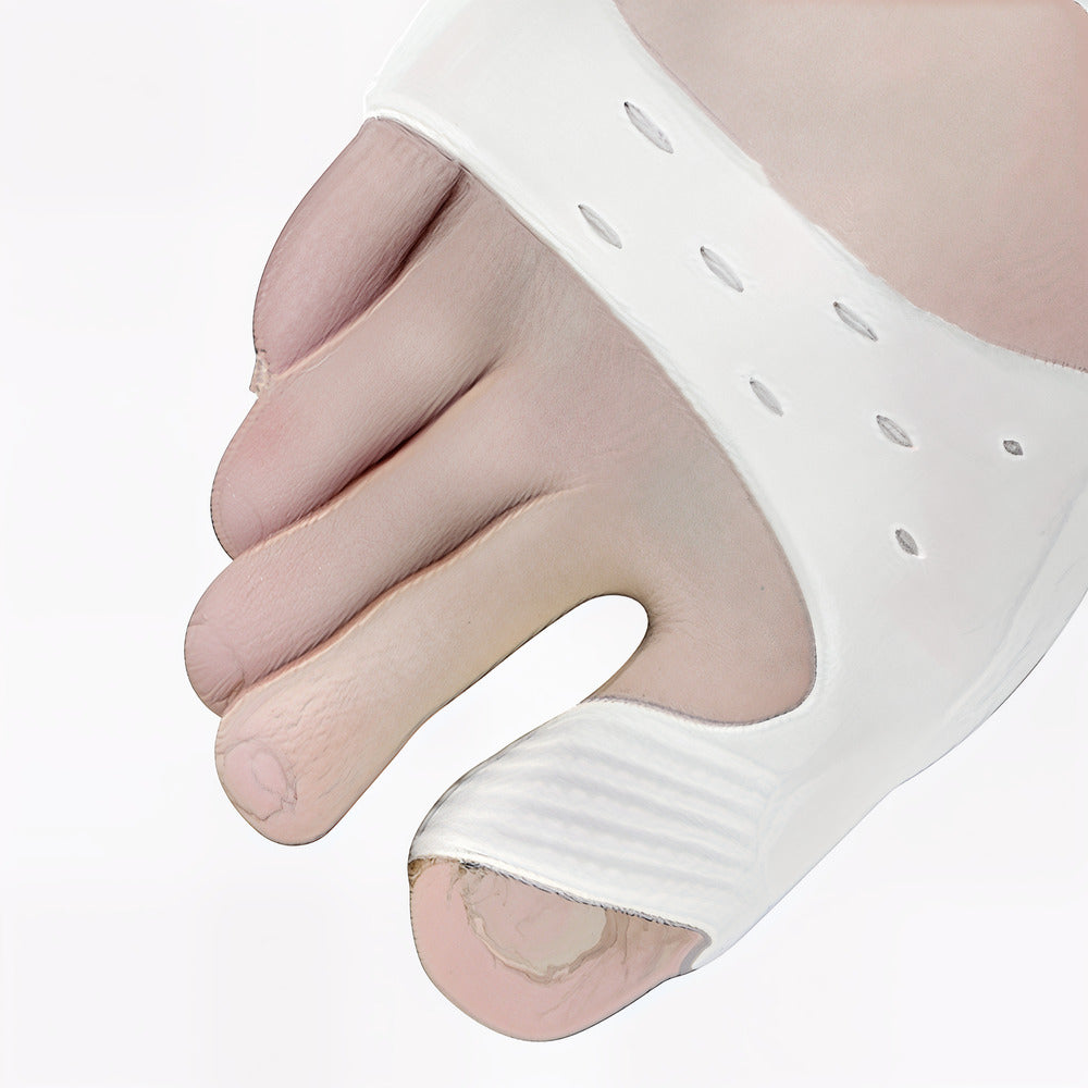 Claw toe orthosis